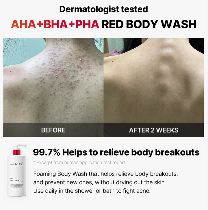 Medicube RED ACNE BODY WASH 2.0 - 400g | ميدي كيوب غسول للجسم ضد حب الشباب - ٤٠٠ غرام