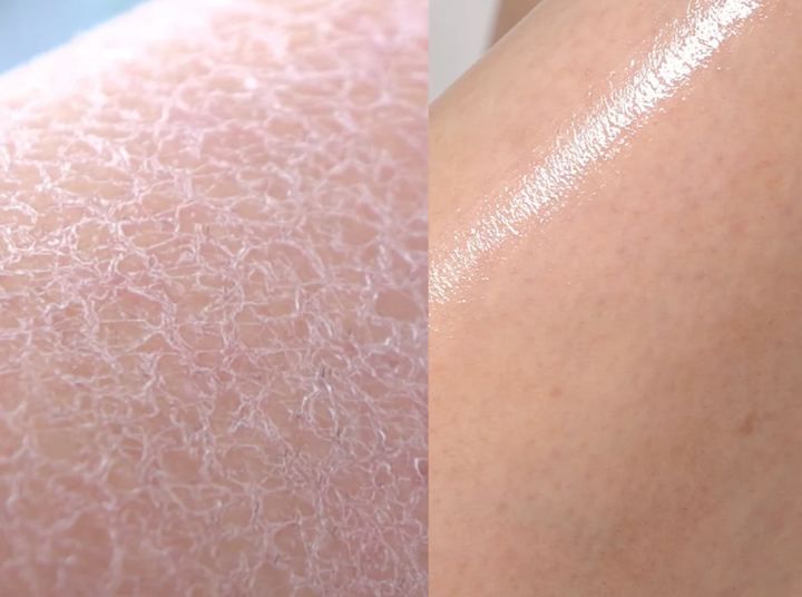 Medicube RED ACNE BODY WASH 2.0 - 400g | ميدي كيوب غسول للجسم ضد حب الشباب - ٤٠٠ غرام