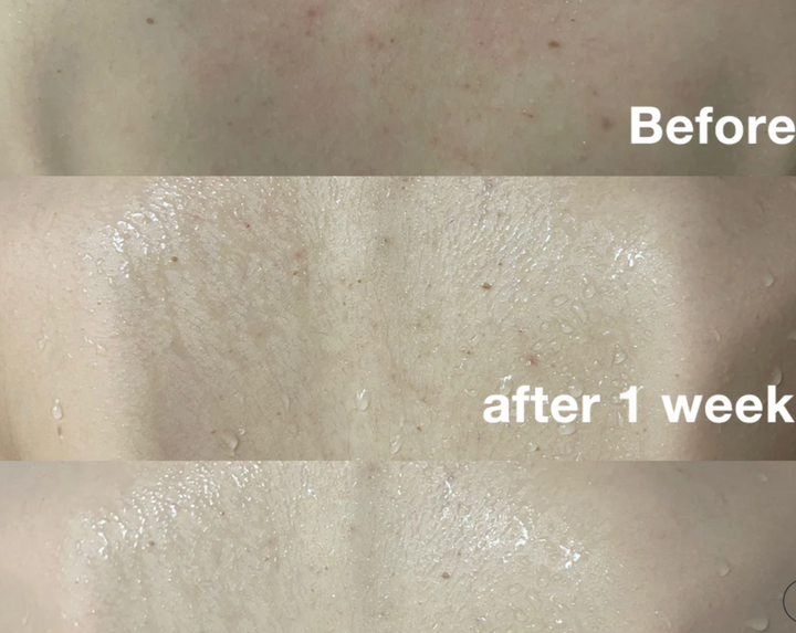 Medicube RED ACNE BODY WASH 2.0 - 400g | ميدي كيوب غسول للجسم ضد حب الشباب - ٤٠٠ غرام