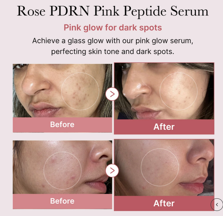 Medicube PDRN PINK PEPTIDE SERUM - 30ML | ميدي كيوب سيروم الببتيدات - ٣٠ مل