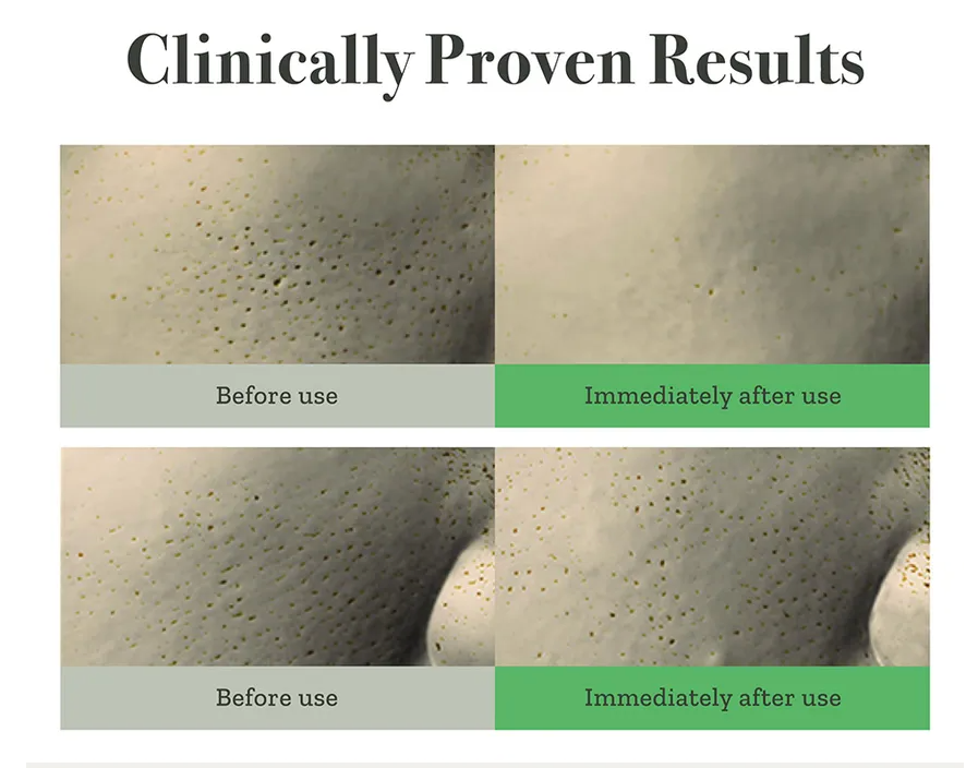 FULLY Green Tomato Serum - 30ml | فولي سيروم مستخلص الطماطم الخضراء - ٣٠ مل