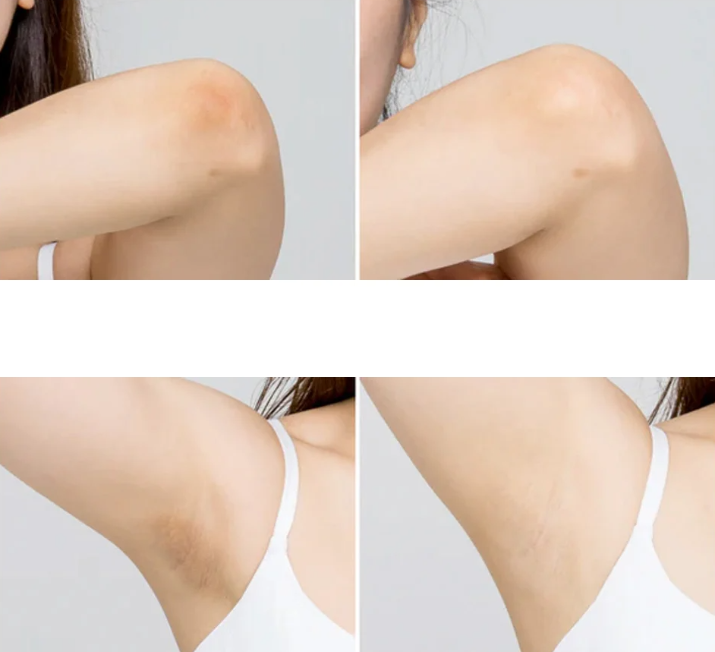 celimax Ji.Woo.Gae One Step Body Brightening Pad - 60pads | سيليماكس شرائح قطنية تفتيح الجسم - 60 قطعة