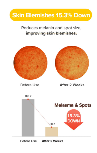 MARY & MAY Rice Niacin 10% Triple Vitamin Serum - 80ml | ماري اند ماي  سيروم الأرز و النياسيناميد 10% - 80 مل