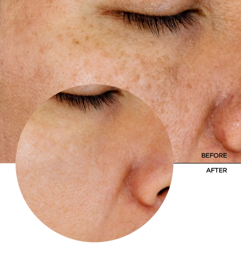 REVOX Glycolic acid exfoliating toner 7% - 250ml | ريفوكس تونر جليكوليك اسيد 7% - 250 مل