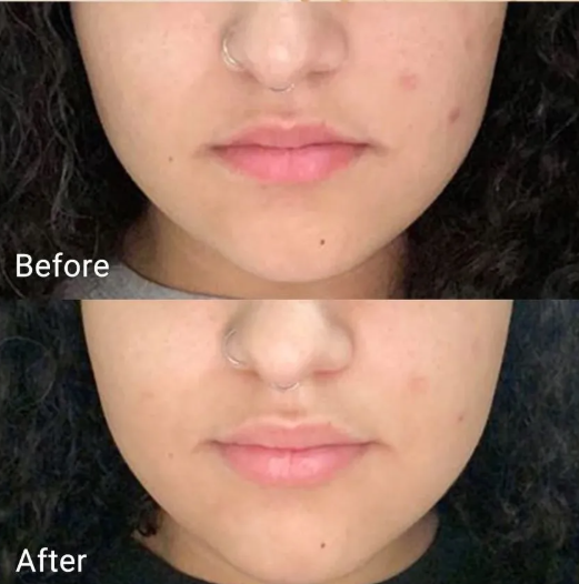 APRILSKIN Real Calendula Peel Off Pack - 100g | أبريل سكين قناع التقشير للوجه بخلاصة زهرة الكاليندولا - 100 غ
