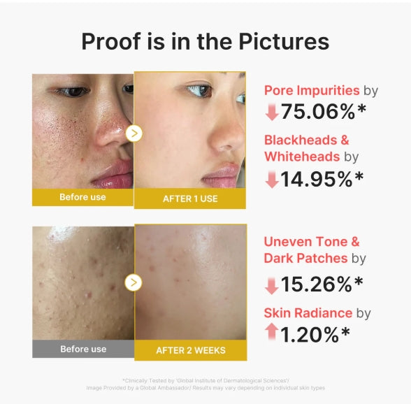 Medicube Kojic Acid Turmeric Peel Shot - 80ml | ميدي كيوب سيروم تقشير لطيف كوجيك أسيد وكركم - 80مل