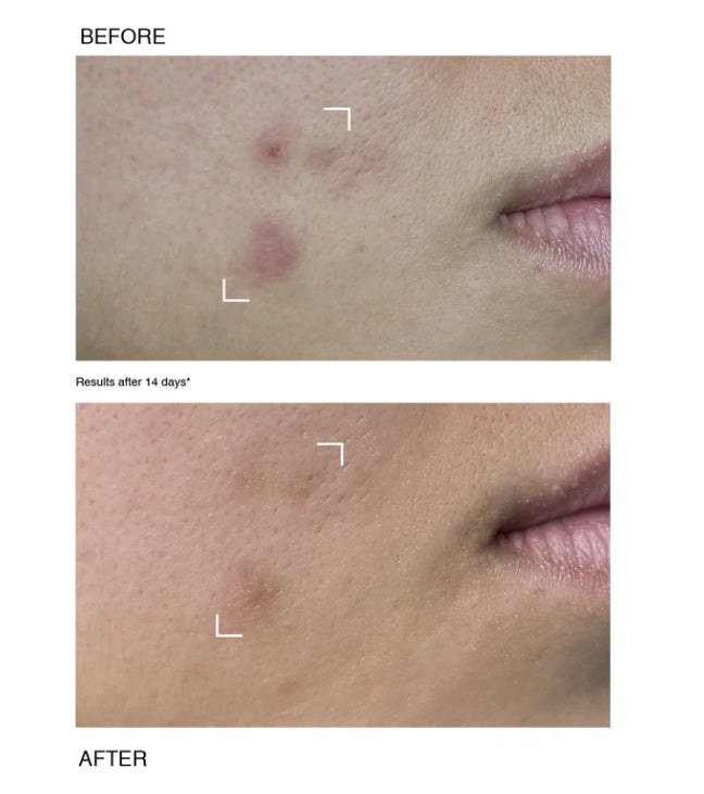 PAYOT PATA GRISE RENEWING PEELING SERUM - 30ml | بايوت سيروم تقشير متجدد - 30مل