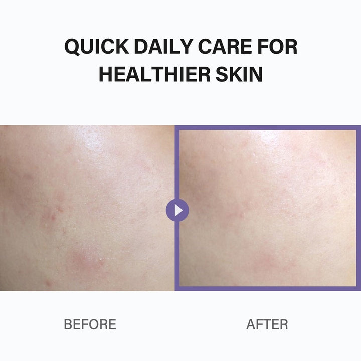 celimax Heartleaf Bha Peeling Pad - 60pcs | سيليماكس وسادات تونر مقشرة بحمض ال BHA - 60 قطعة