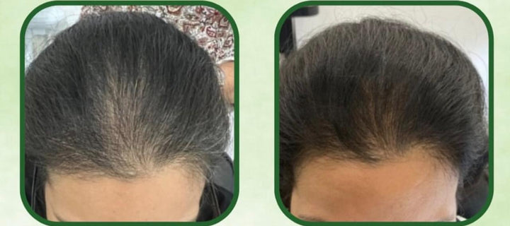 RAUSCH Original Hair Tincture Actively Combats Hair Loss - 200ml | راوش تونك لمكافحة تساقط شعر الرأس - 200 مل