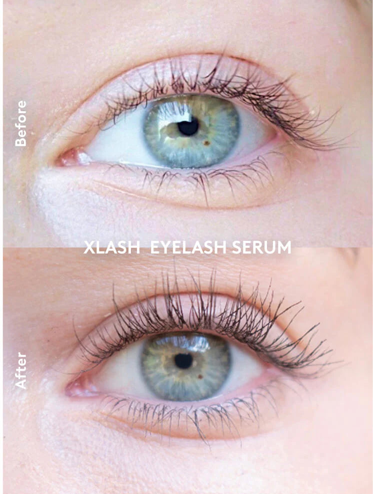 Xlash Eyelash Serum For Longer Fuller Looking Lashes - 3ml | اكس لاش سيروم لتكثيف وتطويل الرموش - 3 مل