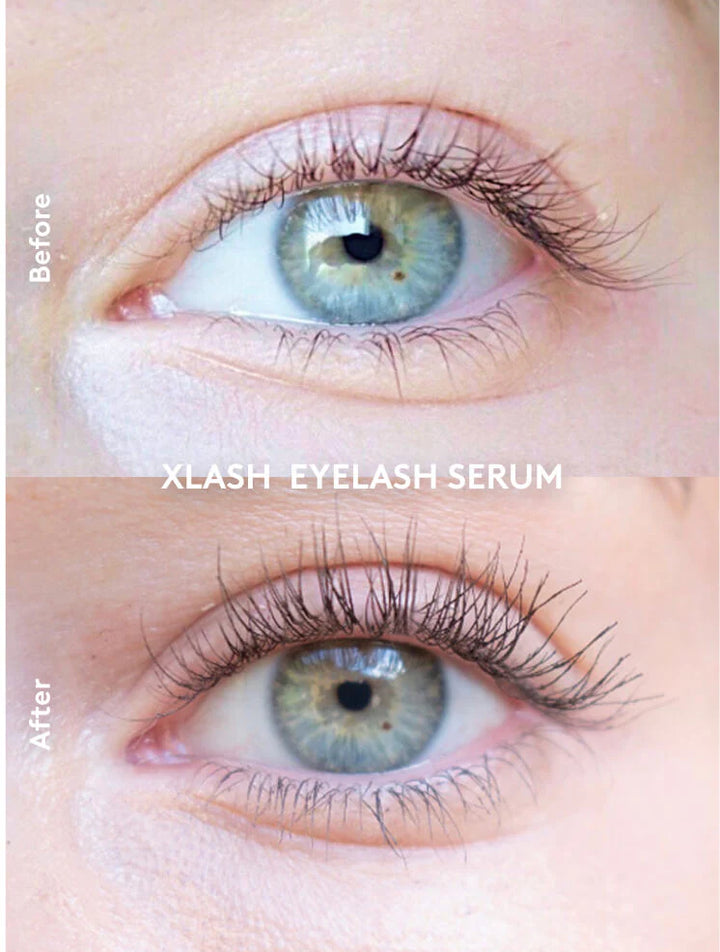Xlash Eyelash Serum For Longer Fuller Looking Lashes - 3ml | اكس لاش سيروم لتكثيف وتطويل الرموش - 3 مل