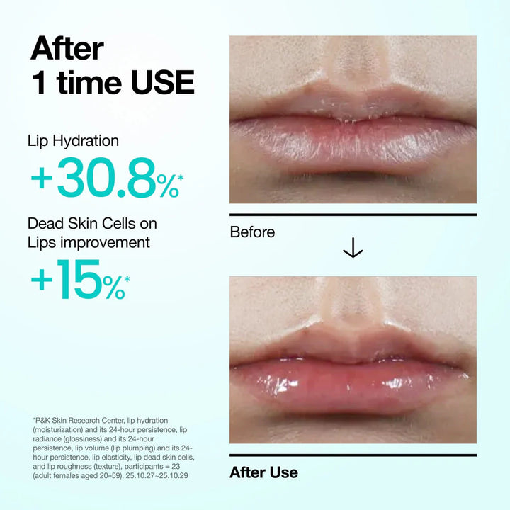 Anua PDRN Hyaluron Lip Serum - 10ml | أنوا سيروم شفاه - 10مل