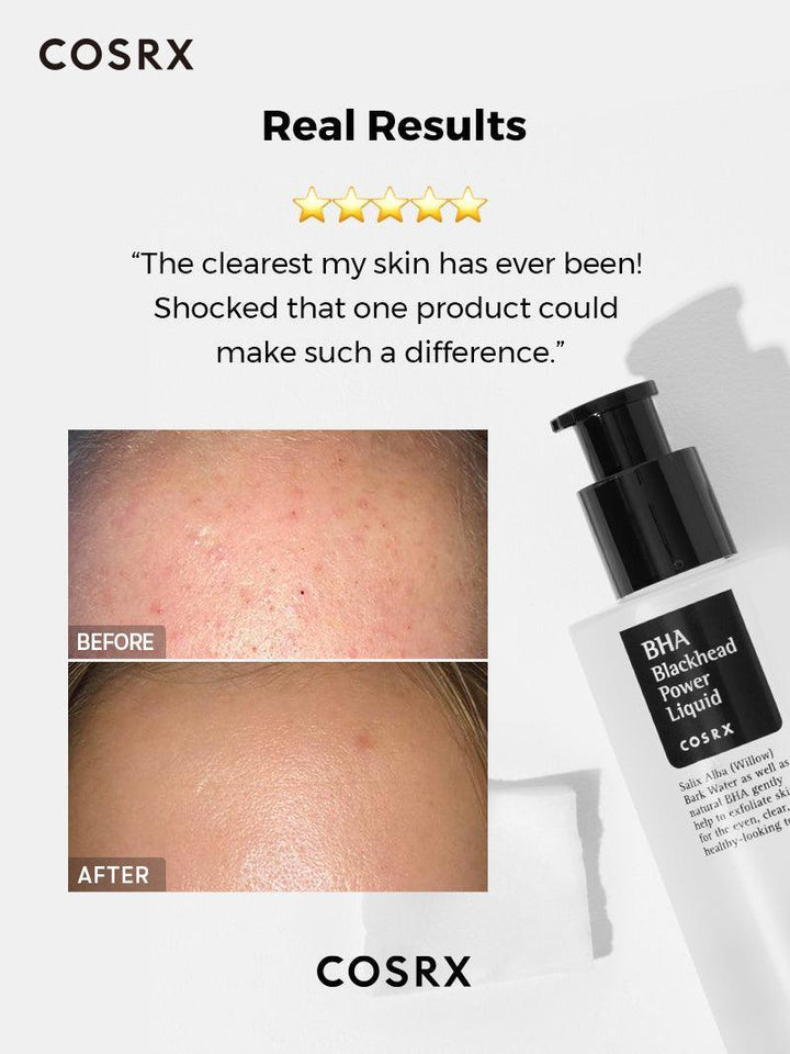 Cosrx BHA Blackhead Power Liquid - 100ml |  كوزركس تونر بحمض البيتا هيدروكس للروؤس السوداء - 100 مل