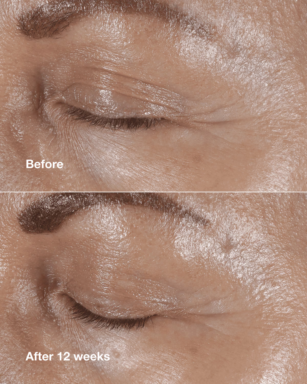 Clinique Smart Clinical Repair Wrinkle Correcting Eye Cream - 15ml | كلينك كريم تحت العين لمعالجة التجاعيد - 15 مل