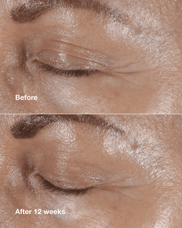 Clinique Smart Clinical Repair Wrinkle Correcting Eye Cream - 15ml | كلينك كريم تحت العين لمعالجة التجاعيد - 15 مل