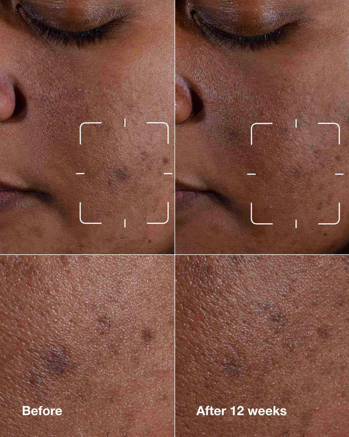 Clinique Even Better Clinical Dark Spot - 50ml | كلينك سيروم للوجه لمعالجة التصبغات - 50مل