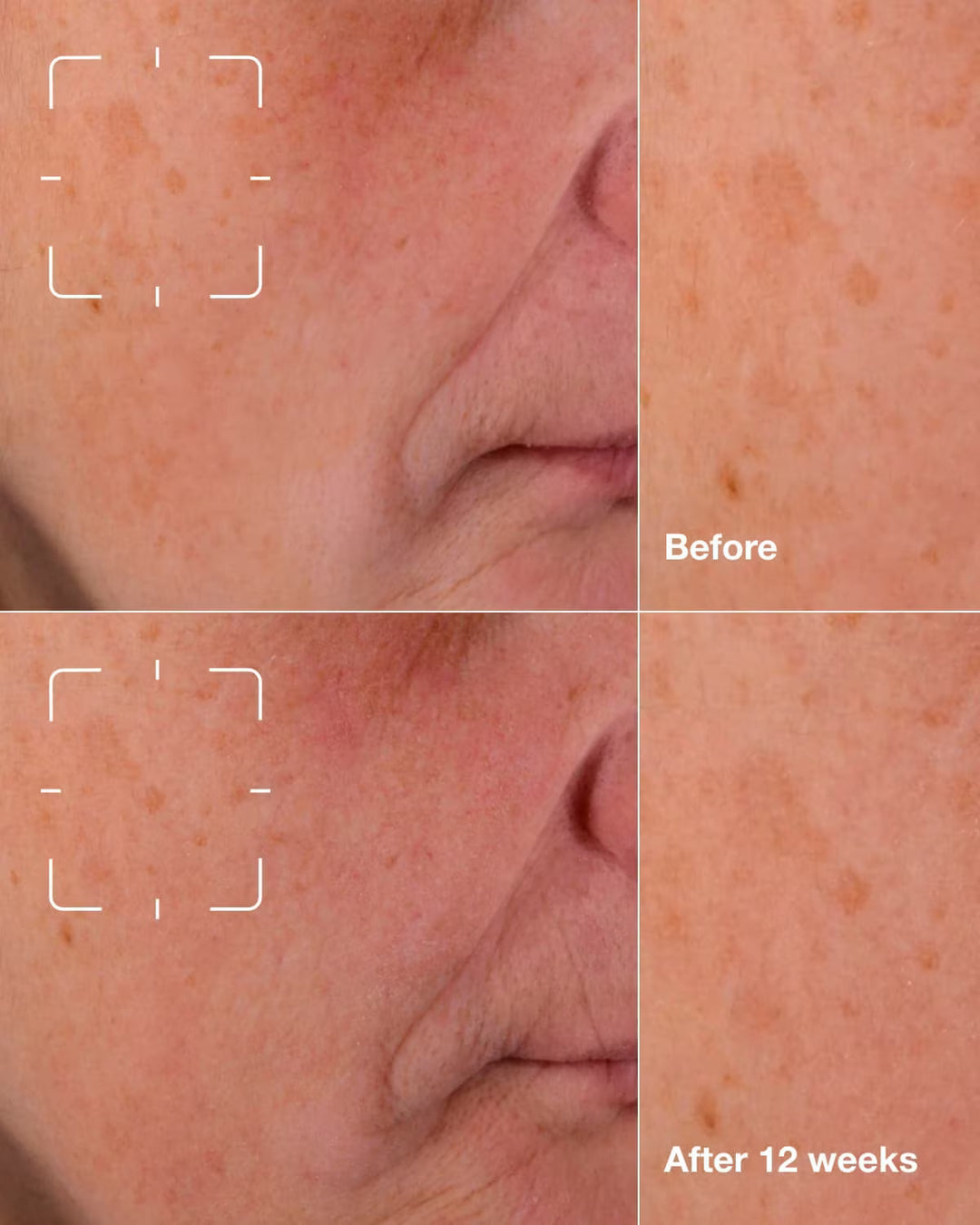 Clinique Even Better Clinical Dark Spot - 50ml | كلينك سيروم للوجه لمعالجة التصبغات - 50مل