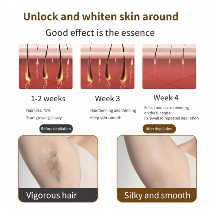 IPL Home Laser Device – Ice Version Light Green |اي بي ال  جهاز إزالة الشعر بالليزر المنزلي  – إصدار الثلجي باللون الأخضر الفاتح