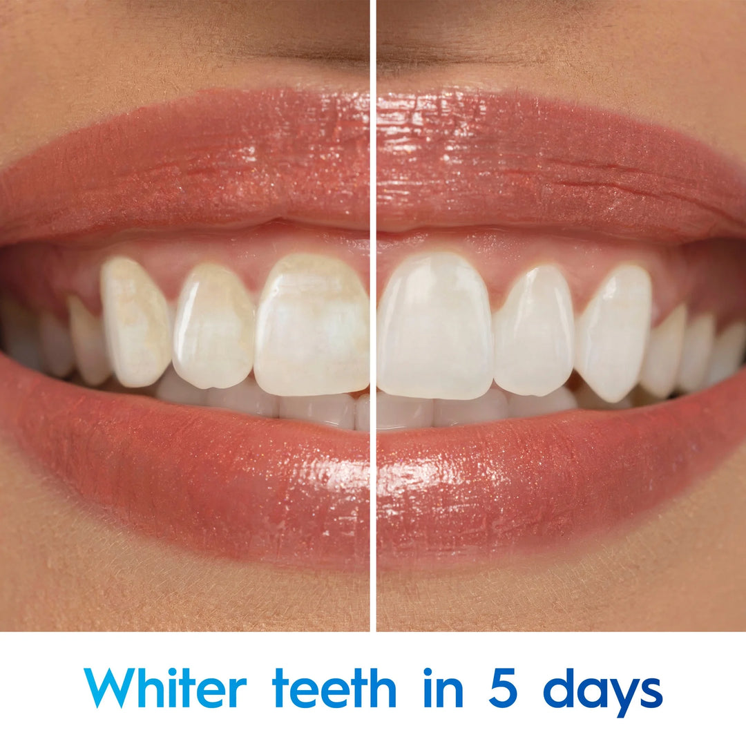 Crest 3D White Advanced Teeth Whitening Toothpaste Radiant Mint - 187g | كريست معجون أسنان مبيض بنكهة النعناع - 187 غ