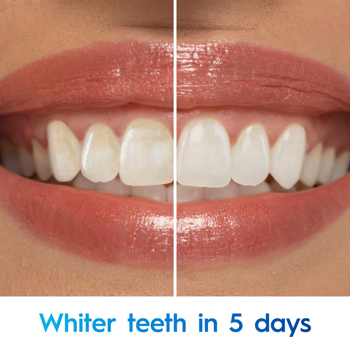 Crest 3D White Advanced Teeth Whitening Toothpaste Radiant Mint - 187g | كريست معجون أسنان مبيض بنكهة النعناع - 187 غ