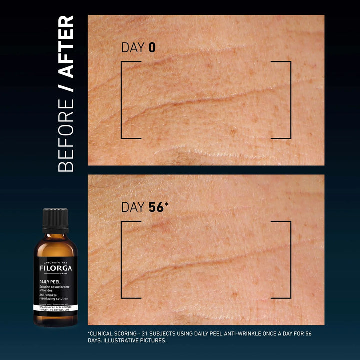 Filorga Daily Peel Anti Wrinkle Resurfacing Solution - 50ml | فيلورجا مضاد للتجاعيد محلول إعادة تجديد البشرة - 50 مل