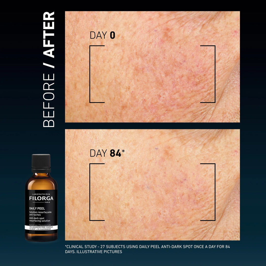 Filorga Filorga Daily Peel Anti Dark Spot Resurfacing Solution - 50ml | فيلورجا محلول مضاد للبقع الداكنة - 50مل