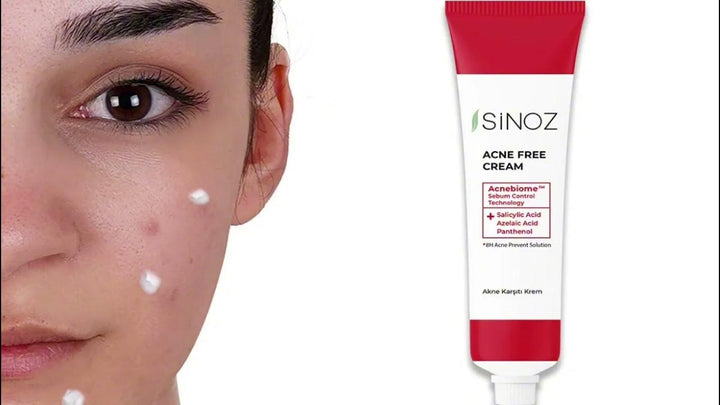 Sinoz Acne Free Acne Cream - 15ml | سينوز كريم المضاد لحب الشباب – 15 مل