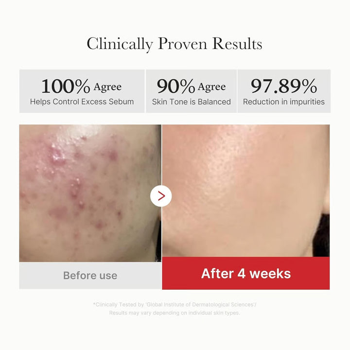 Medicube Red Succinic Acid Peeling 70 Pads - 155g | ميدي كيوب وسادات تقشير حمض السكسينيك الاحمر 70 وسادة - 155غ