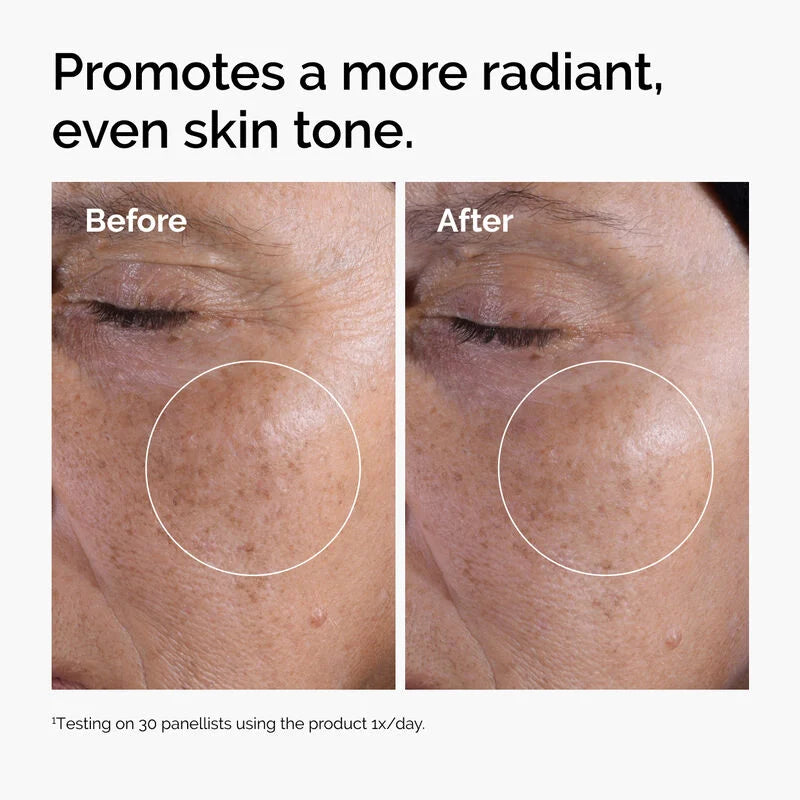 The Ordinary Glycolic Acid 7% Exfoliating Toner - 100ml| ذا أورديناري تونر غلايكوليك اسيد7%-100مل
