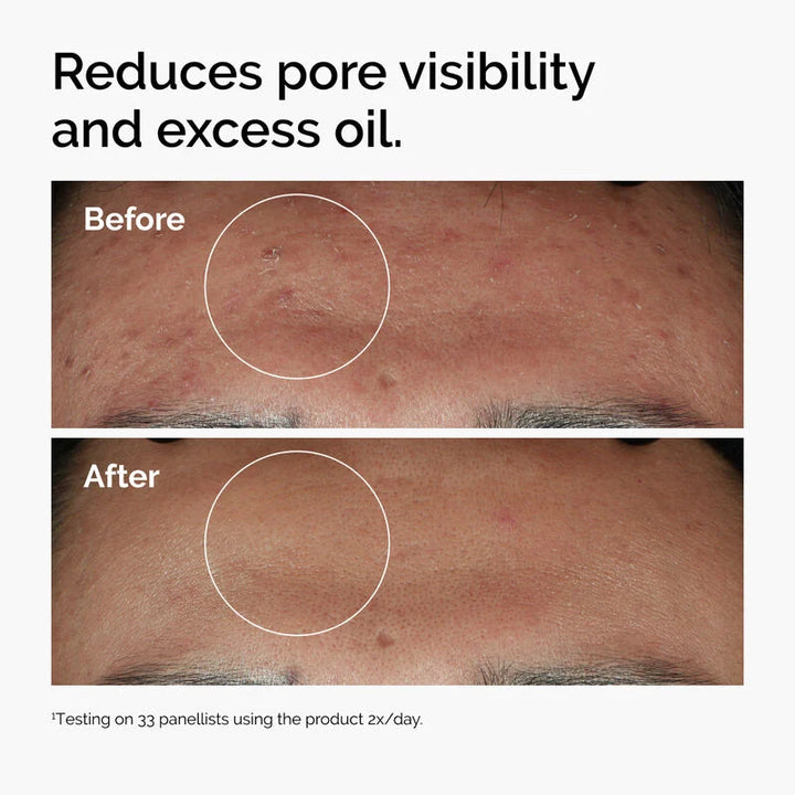 The Ordinary Niacinamide 10% + Zinc 1% - 60ml | ذا أورديناري سيروم نياسيناميد وزنك - 60 مل