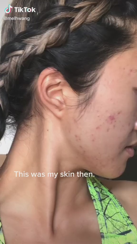 LA ROCHE-POSAY Effaclar Micro Peeling Purifying Gel - 200ml | لاروش بوزيه غسول جل منقي للوجه - ٢٠٠ مل