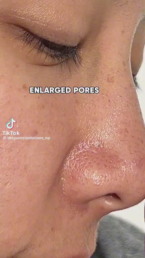 The Purest Solutions Intensive Pore Tightening And Lightening Serum - 30ml | ذا بيورست سيروم تفتيح و المسام الواسع - 30 مل