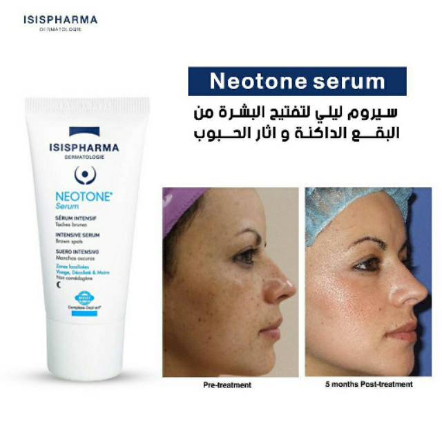 Seruma Neotone Intense Depigmenting - 30ml | Serûma li dijî pîgmentasyonê ya konsantrekirî - 30ml