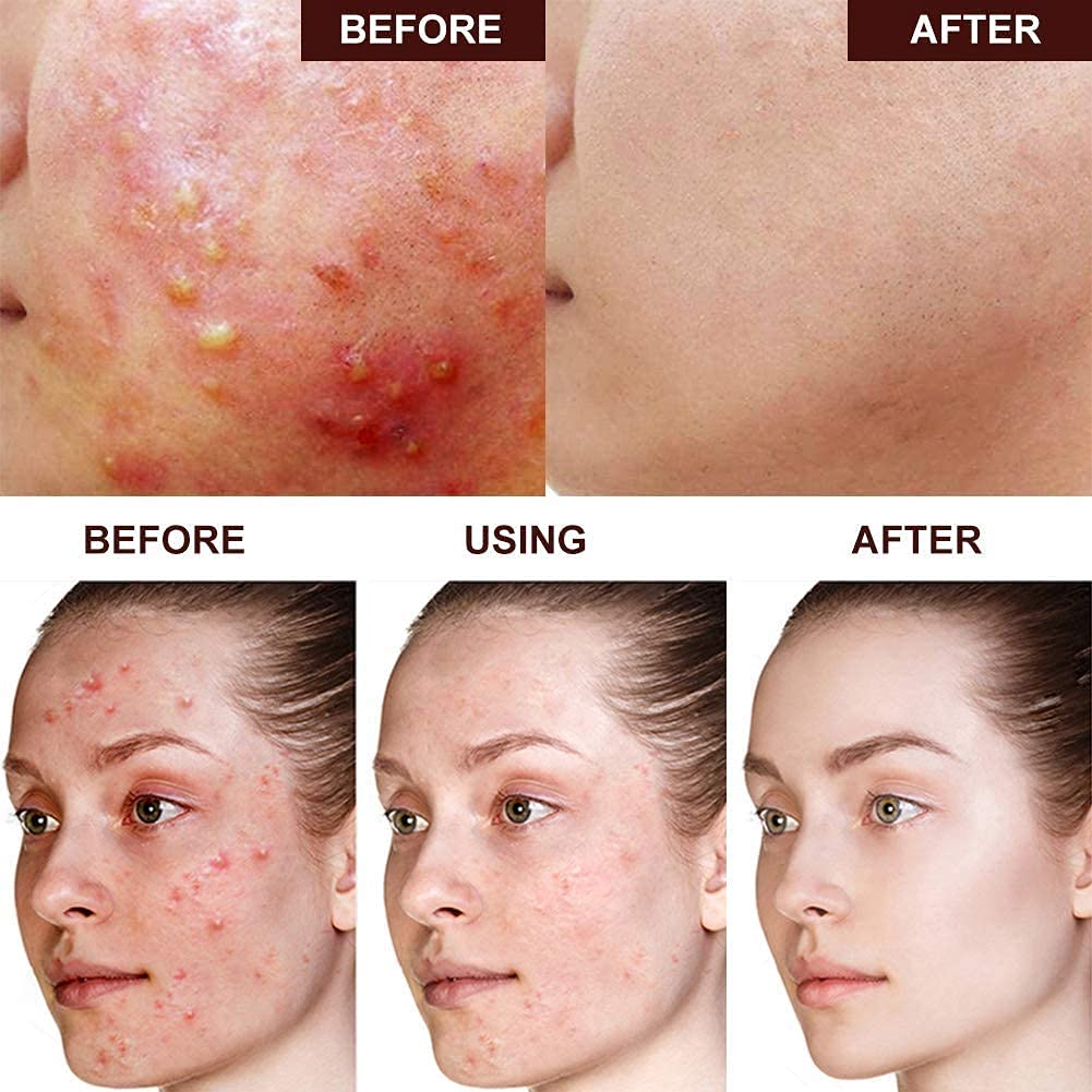 Cetaphil Gentle Skin Cleanser  Dry To Normal Sensitive Skin - 237ml | سيتافيل غسول لطيف للبشرة الجافة إلى العادية والحساسة - 237 مل