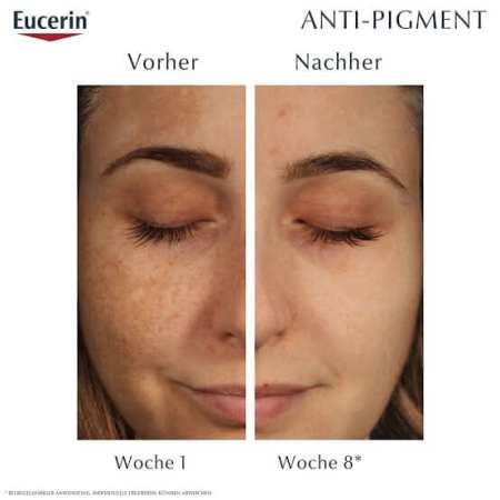 Eucerin Anti-Pigment Night Cream - 50ml | كريم ليلي مضاد للتصبغ - 50 مل