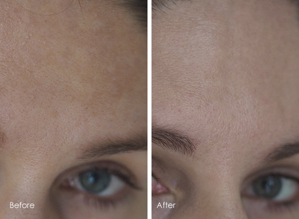 BIODERMA Pigmentbio Foaming Cream | بيوديرما غسول فومي للتصبغات