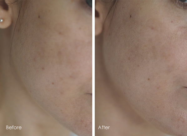 BIODERMA Pigmentbio Foaming Cream | بيوديرما غسول فومي للتصبغات