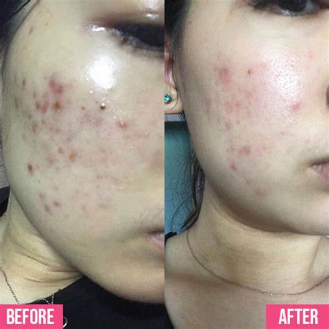 LA ROCHE-POSAY Effaclar Purifying Foaming Gel - 200ml | لاروش بوزيه غسول للبشرة - 200 مل