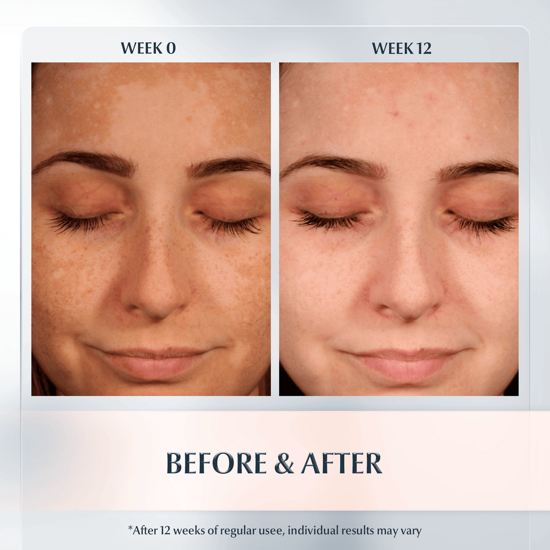 Eucerin Anti-Pigment Night Cream - 50ml | كريم ليلي مضاد للتصبغ - 50 مل