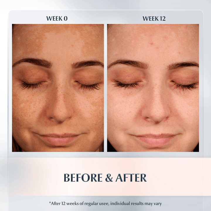 Eucerin Anti-Pigment Night Cream - 50ml | كريم ليلي مضاد للتصبغ - 50 مل