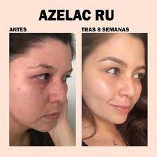 Sesderma Azelac RU Serum liposomal - 30ml | سيسديرما ازيليك اسيد سيروم ليبوسوميد - 30 مل
