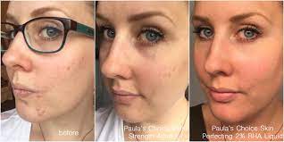 Paula’S Choice Skin Perfecting 2% Bha Liquid - 30ml | باولا تشويس تونر مقشر بالسالسيليك أسيد 2% - 30 مل