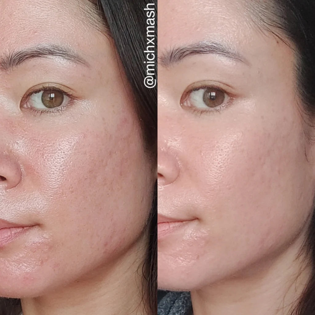 LA ROCHE-POSAY Cicaplast Baume B5+ Repairing Balm - 100ml | لاروش بوزيه سيكابلاست مرمم بانتينول - 100 مل