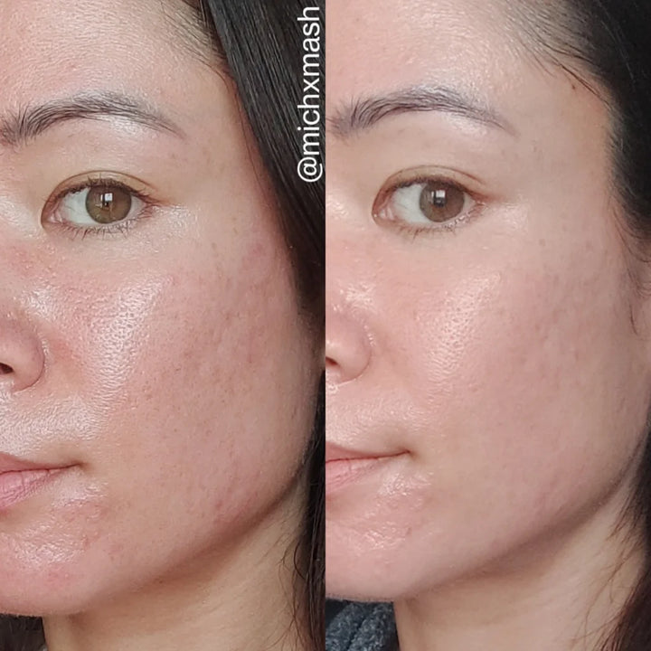 LA ROCHE-POSAY Cicaplast Baume B5+ Repairing Balm - 100ml | لاروش بوزيه سيكابلاست مرمم بانتينول - 100 مل