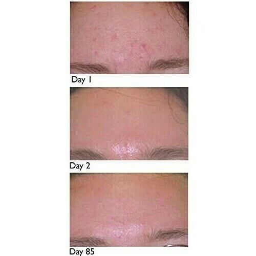 AcneVit Anti-Acne Cleansing Gel - 200ml | اكني فيت غسول مضاد لحب الشباب واثارة  بالنيسنمايد وفيتامين سي  والسينتيلا - 200 مل