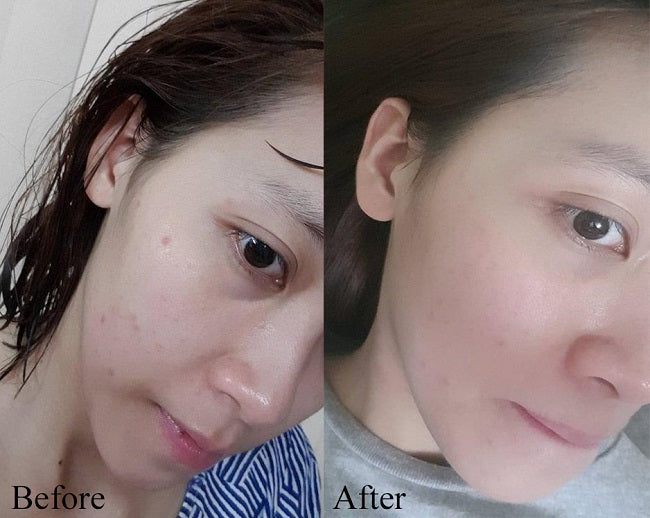 SVR Sebiaclear Serum Correcteur - 30ml | اس في ار سيبياكلير سيروم مصحح كلي للوجه - 30 مل